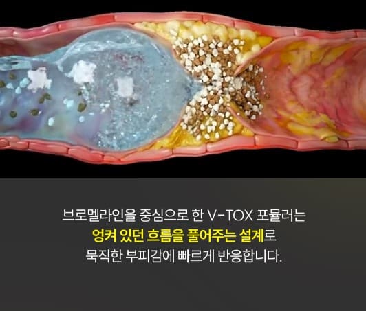 브로멜라인 효능