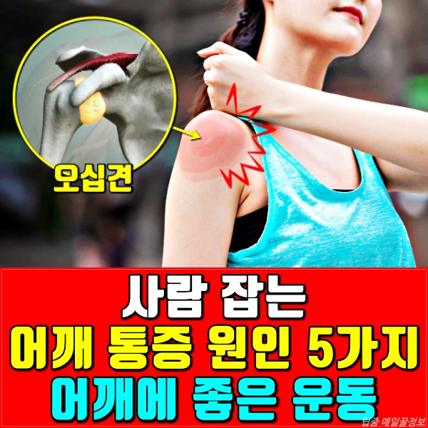 어깨통증 원인,오십견 증상,회전근개파열 치료,어깨 아플때 운동,건강 팁줌 매일꿀정보