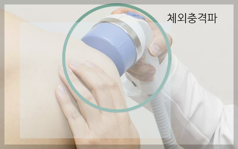 석회성 힘줄염 체외충격파치료