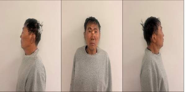 인천 흉기난동 최충락 신상공개｜59세 머그샷&middot;8명 부상&middot;19세 여성 상태&middot;과거 살인미수 전과 총정리