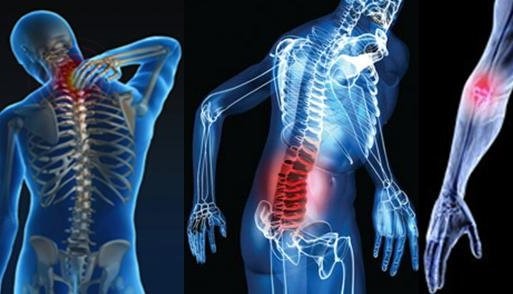 직장에서 근골격계 부담 작업의 범위