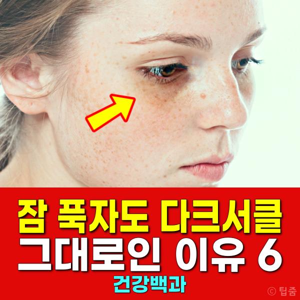 눈밑 지방 다크서클 원인