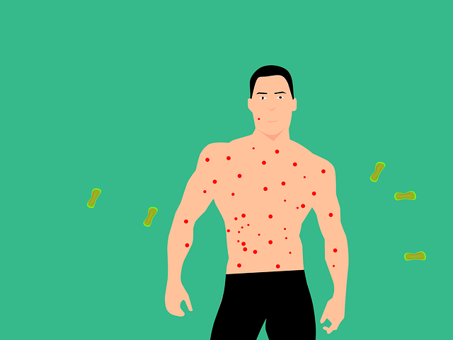 골다공증 검사비용 1