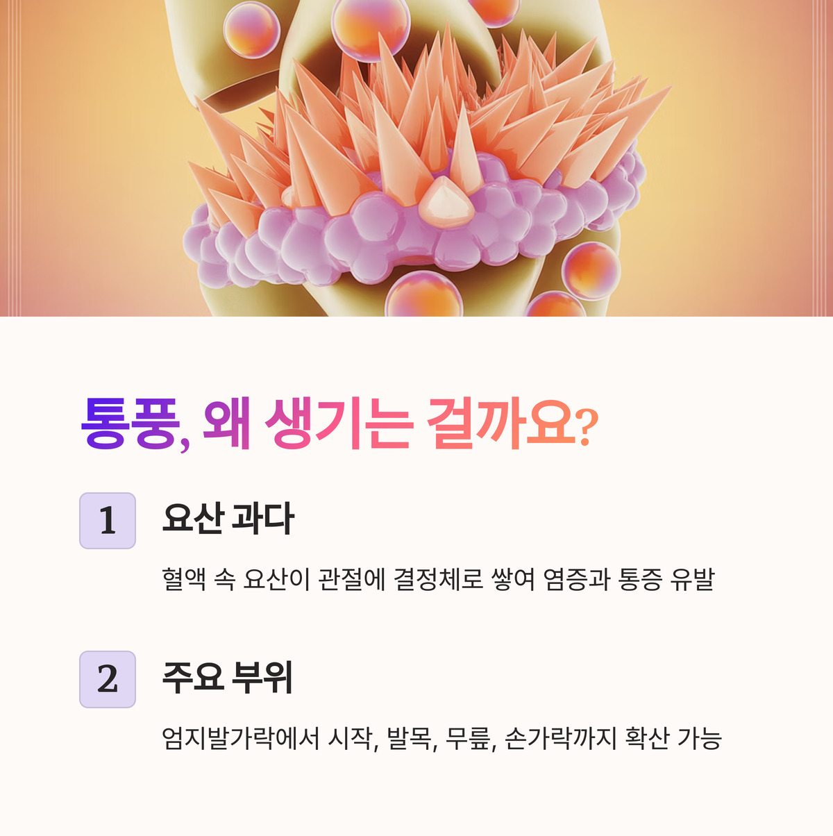 통풍, 왜 생기는 걸까?