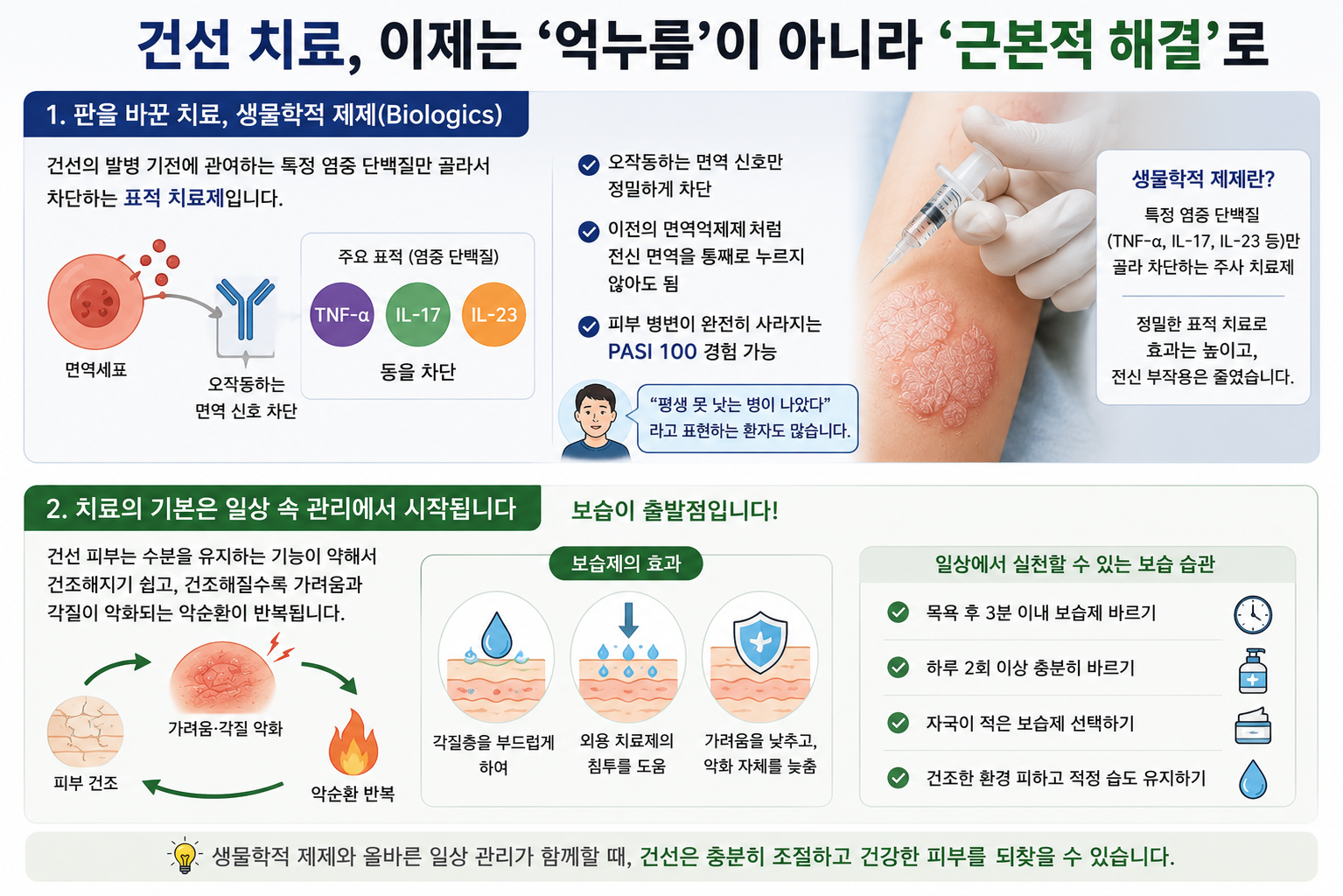 건선치료 방법 정리