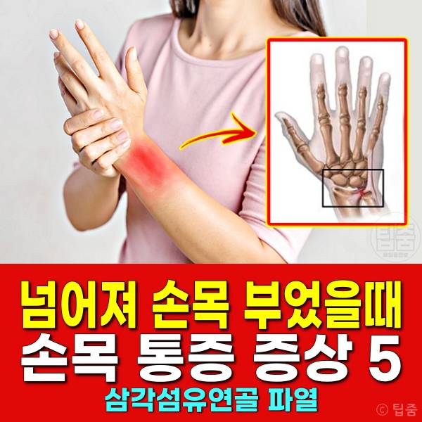 넘어져서 손목이 부었을때 손목통증 삼각섬유연골파열 증상