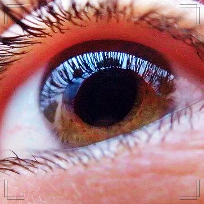 healthy-eye