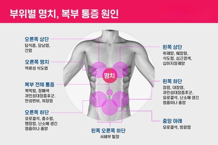 명치통증 원인 위치 역류성 식도염 급체 명치 가슴 통증 예방법