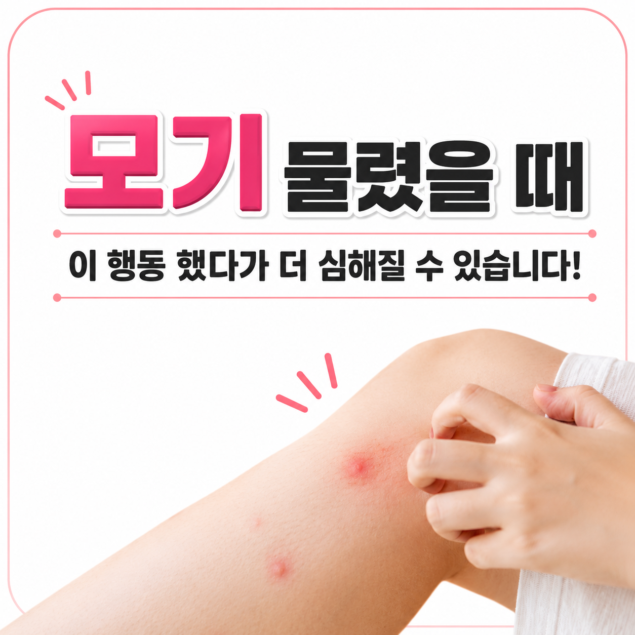모기 물린 이미지