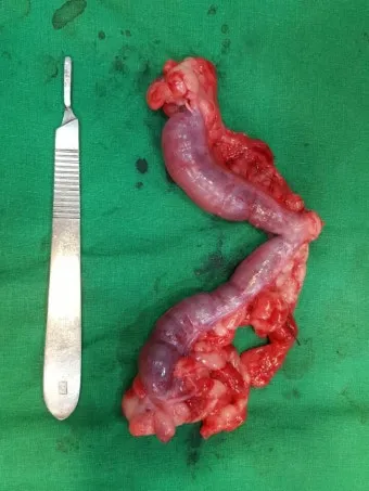 강아지 백내장 수술비용 현실 증상 예방법 보호자 가이드 정리_14