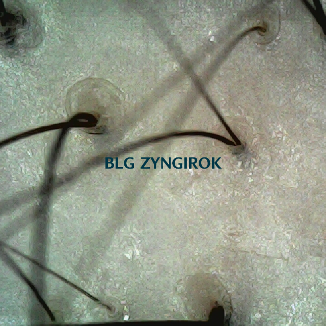 피나모아 복용 14주차 두피 사진 정수리와 이마 사이 모습이다.