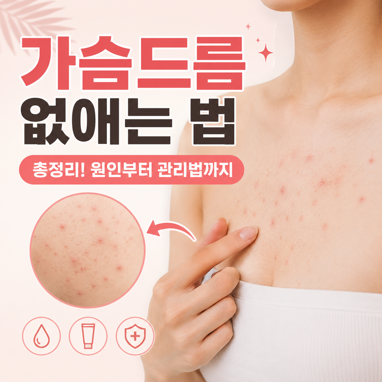 가드름 없애는 법