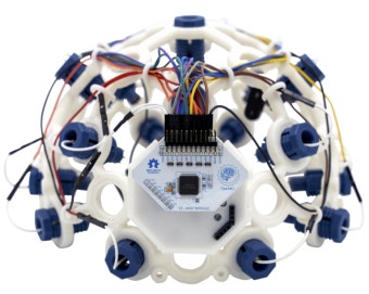 뇌의 전기 에너지