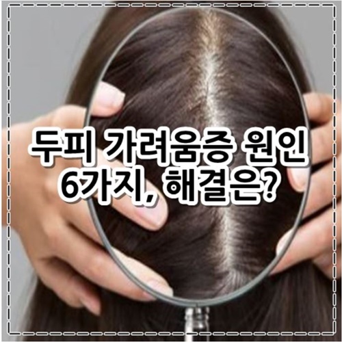 두피 가려움증 원인 6가지, 해결법