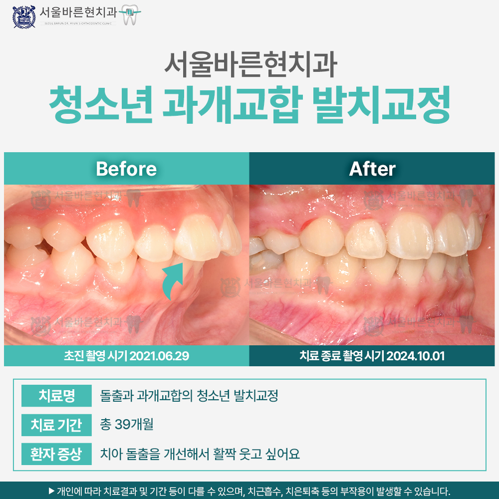 부산교정치과