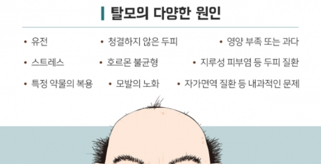 탈모의 원인