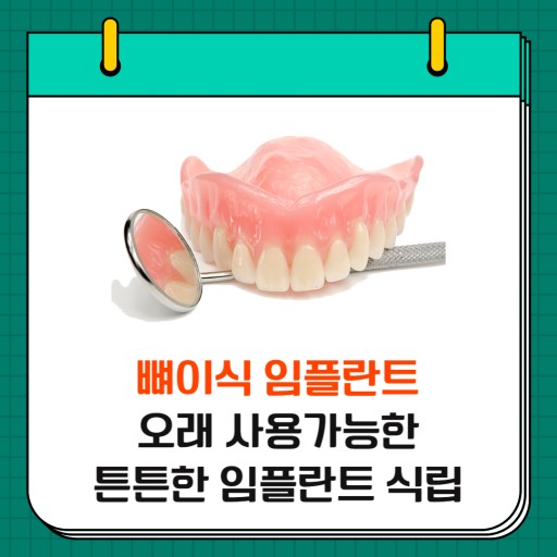 임플란트 주의점