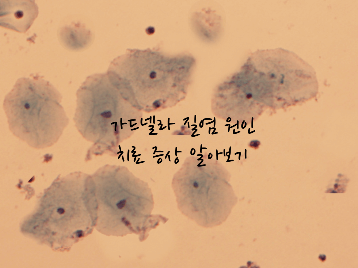 가드넬라 질염