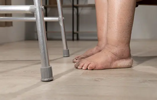 신장이 안좋으면 나타나는 증상 10가지&amp;#44; 미리 알고 예방하자