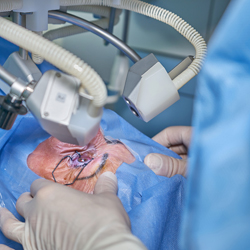 안과수술장면예시02