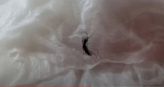 [한 가족의 실제 현상] 몸 속에서 이상한 게 나올 때 대처법 