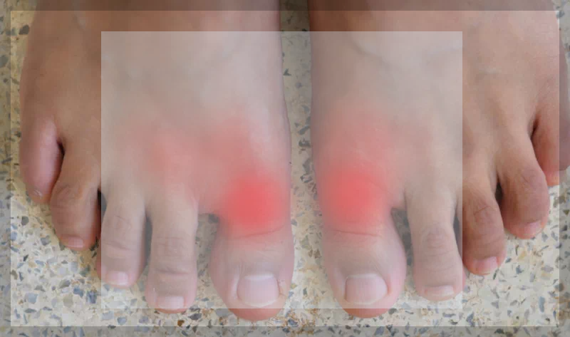 엄지 발가락 마디 통증