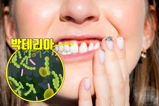 장염 잘 생기는 사람 이유 잇몸질환 치주염