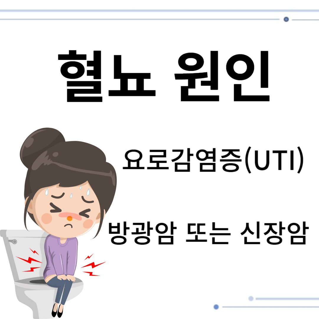 혈뇨원인