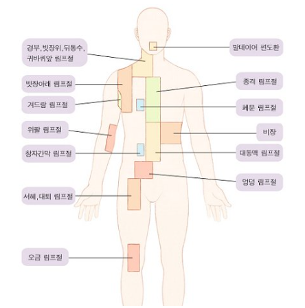 림프절 발병위치