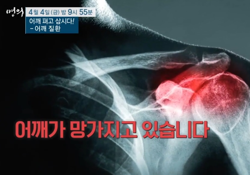 어깨질환-명의