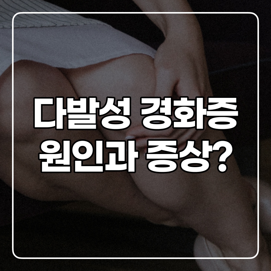다발성 경화증 초기 증상