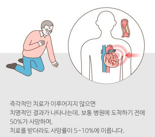 심장혈관 응급상황