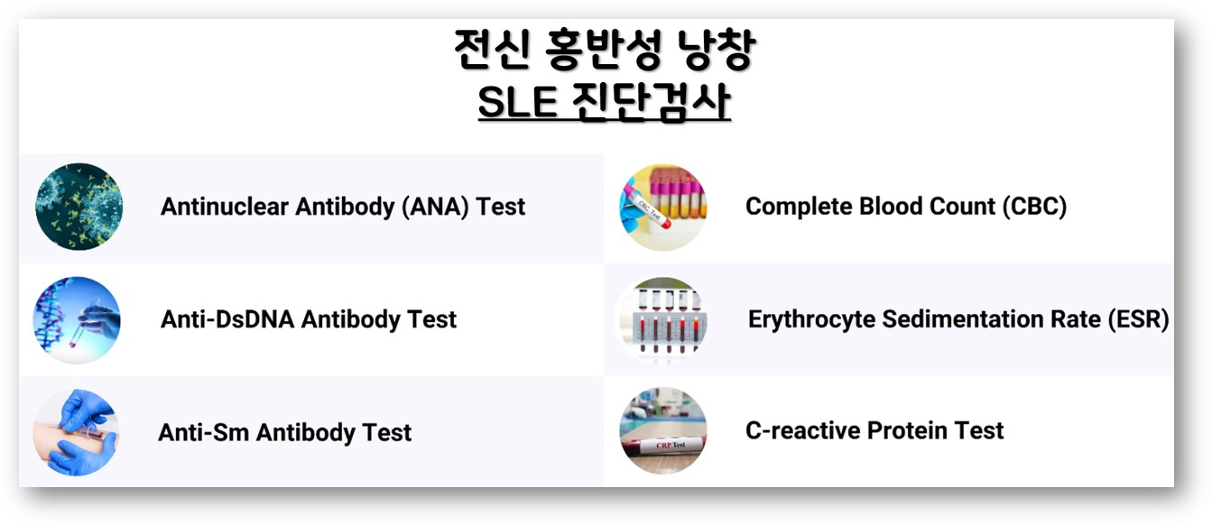 전신홍반성낭창 진단검사