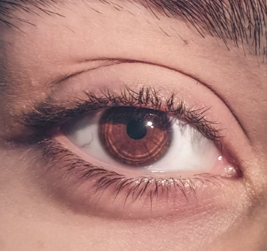 황반변성 치료법 자가진단 방법 합병증