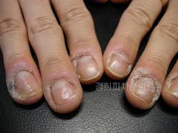 손톱과 수분 섭취의 연관성