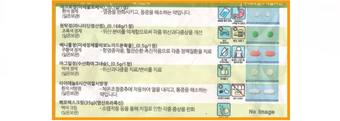 치핵 수술 후, 처방 약