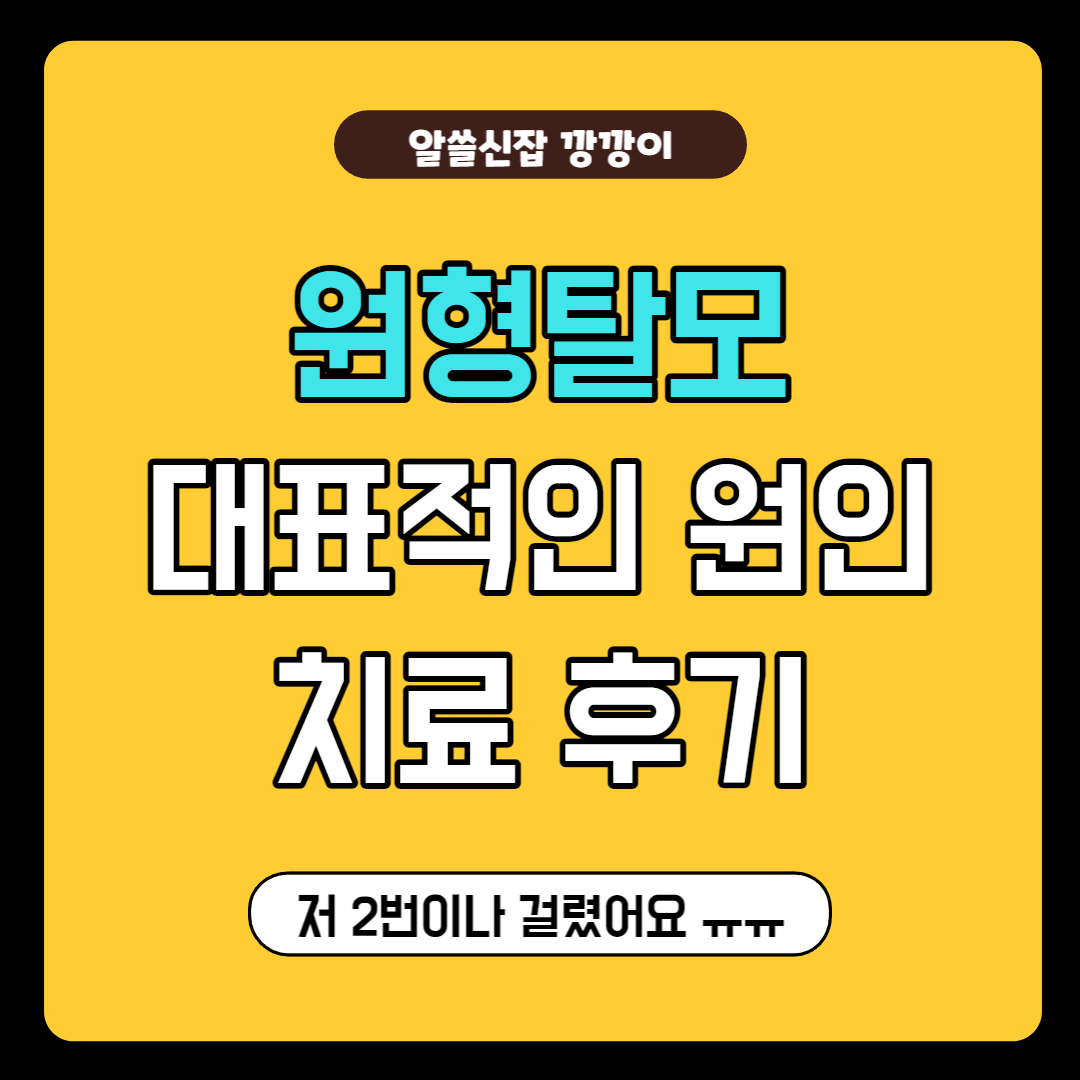 원형탈모 치료후기