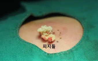 남자 얼굴 피지 제거 화장품 꿀템_17