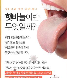 혓바늘이 돋는 이유 알아보기