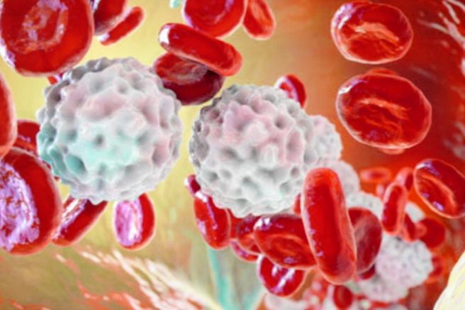 Lymphocyte 수치