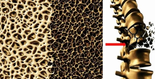 마그네슘 부족증상, 마그네슘 결핍의 7가지 증상