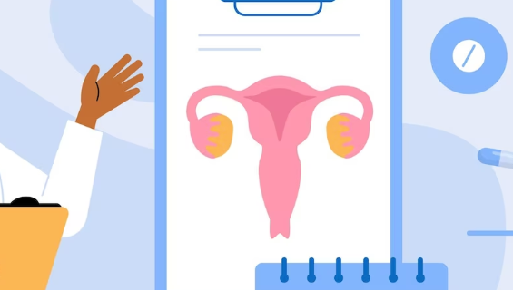 자궁근종의 원인