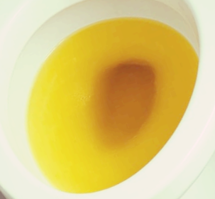 소변 색깔로 보는 건강