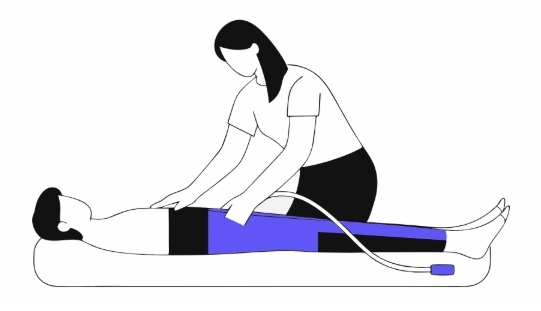 하지정맥류 치료 과정