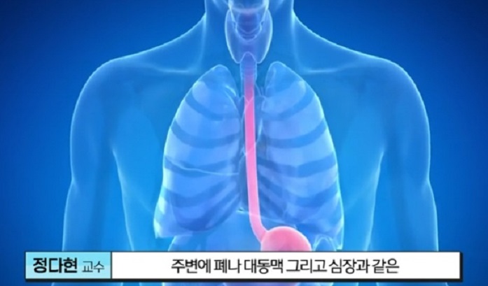 EBS명의-식도암-박종재-교수