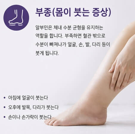 알부민 부족증상