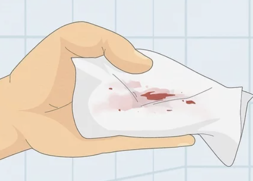 대변에-피가-나오는-증상