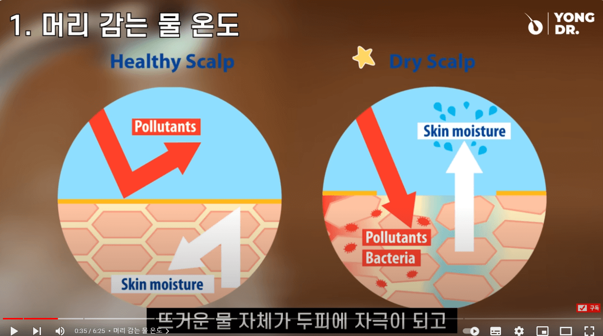 머리 감을 때 절대 하지 말아야 할 행동(9가지)-의사강력추천! ##탈모 #지루성두피염 #머리감기습관 #지루성피부염 #탈모예방 #탈모치료 #두피여드름 #두피뾰루지 #두피건선 #두피가려움 #비듬 #두피각질 #지루성두피염관리 #두피관리 #탈모관리#탈모 #지루성두피염 #머리감기습관 #지루성피부염 #탈모예방 #탈모치료 #두피여드름 #두피뾰루지 #두피건선 #두피가려움 #비듬 #두피각질 #지루성두피염관리 #두피관리 #탈모관리 태그 삭제#탈모탈모 태그 삭제#지루성두피염지루성두피염 태그 삭제#탈모 머리감는 법탈모 머리감는 법 태그 삭제#탈모 머리감기탈모 머리감기 태그 삭제