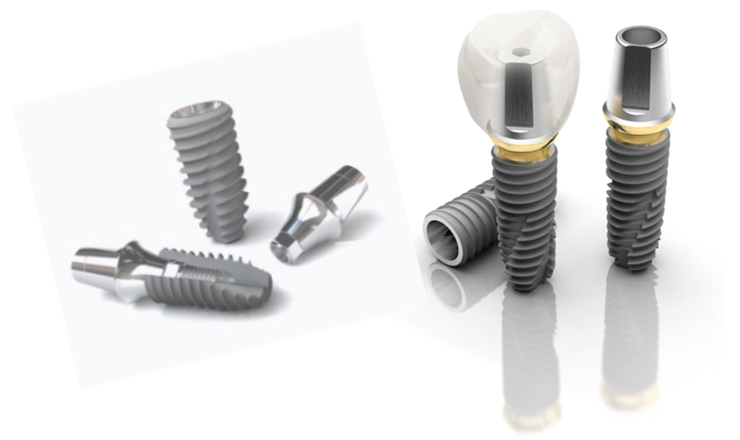 오스템 임플란트