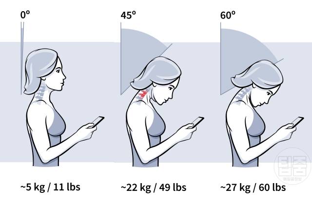 스마트폰 중독 증상 휴대폰 중독 증상 부작용 거북목